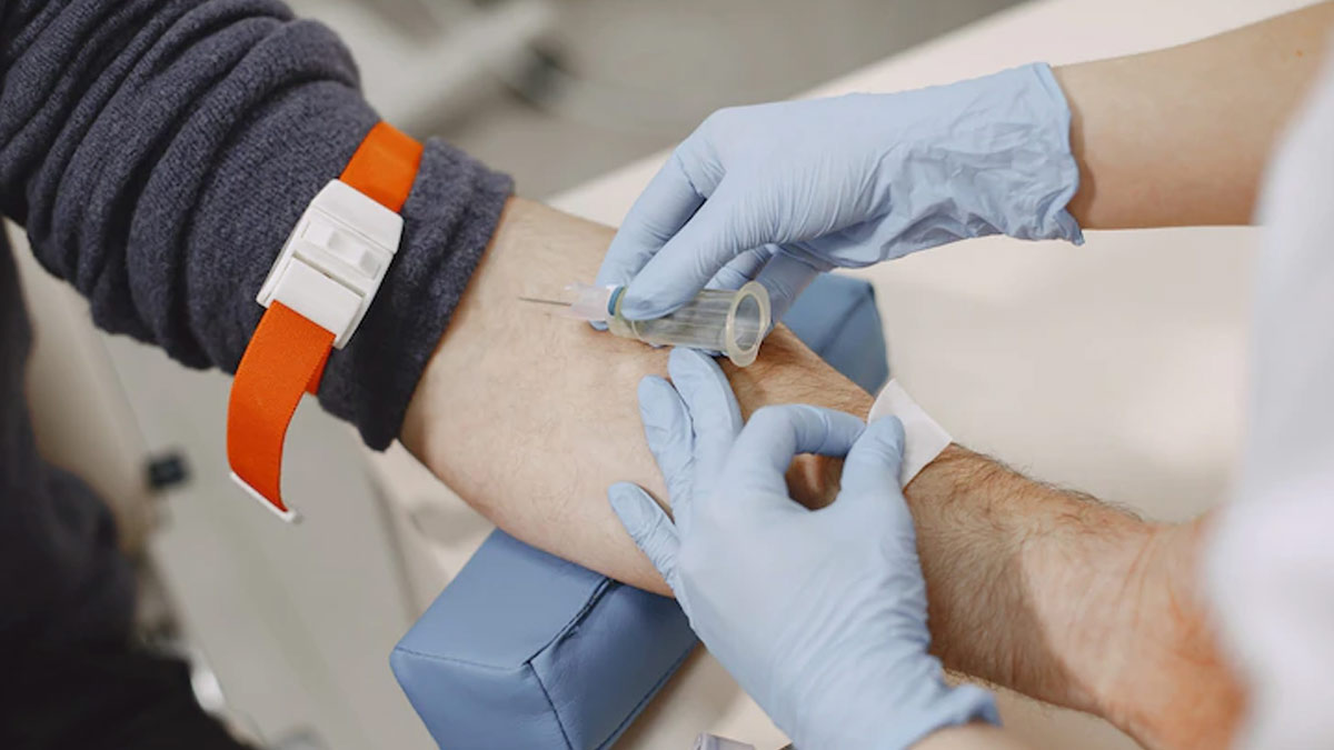 Study Blood Test Can Predict The Risk Of Metastasis In Melanoma